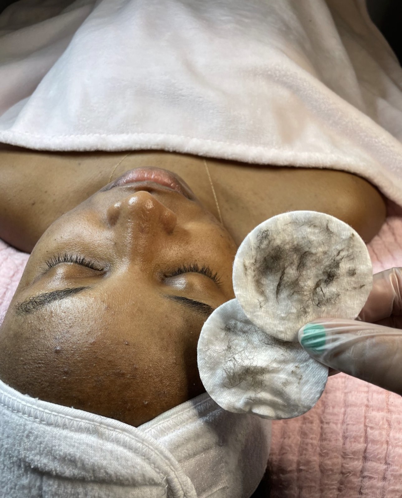 Close-up of a woman receiving a facial treatment with cotton pads